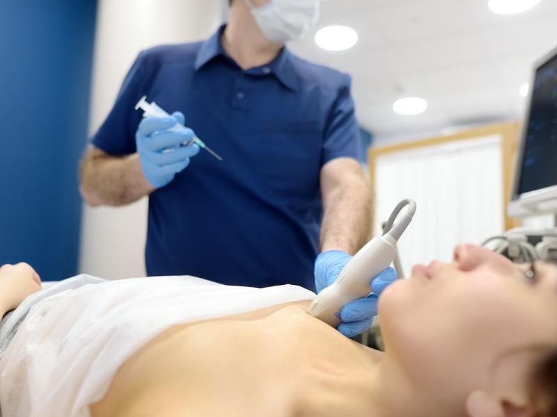 Respondendo as principais dúvidas sobre fibroadenoma